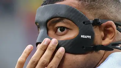 Килиану Мбаппе сломали нос в матче с Австрией