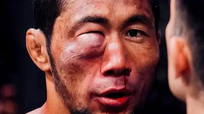 UFC