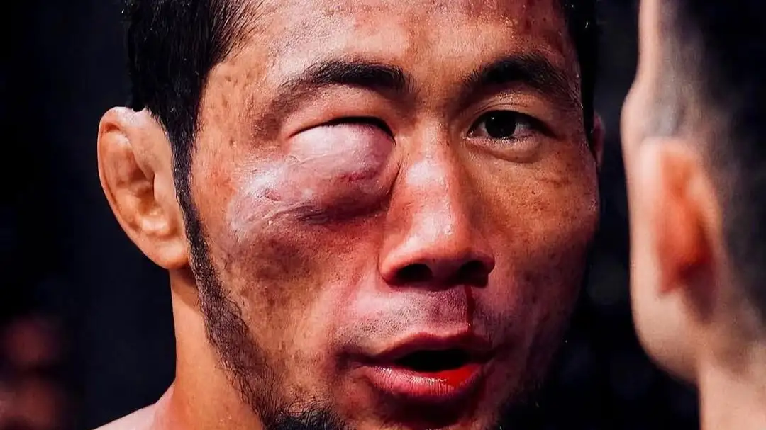 UFC UFC
