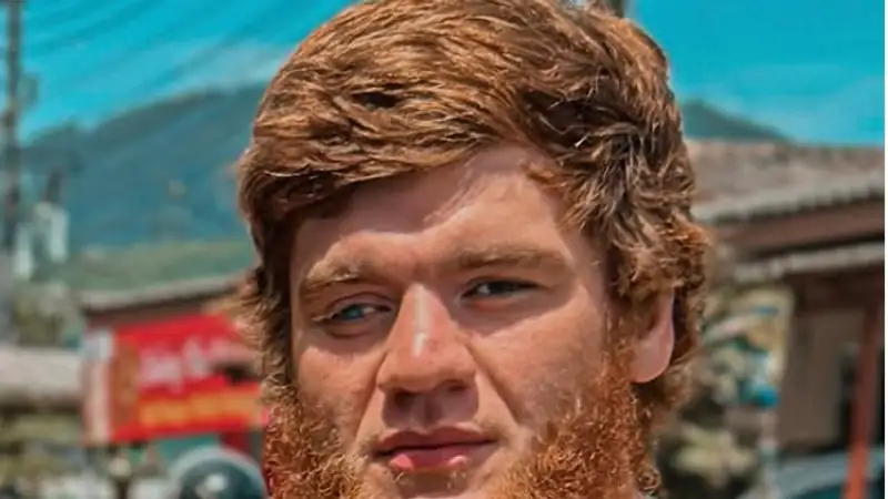 Буллета прооперировали 