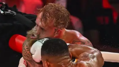 "Дайте "Канело" через 10 дней": Джейк Пол опубликовал снимок сломанной челюсти